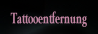 Tattooentfernung.